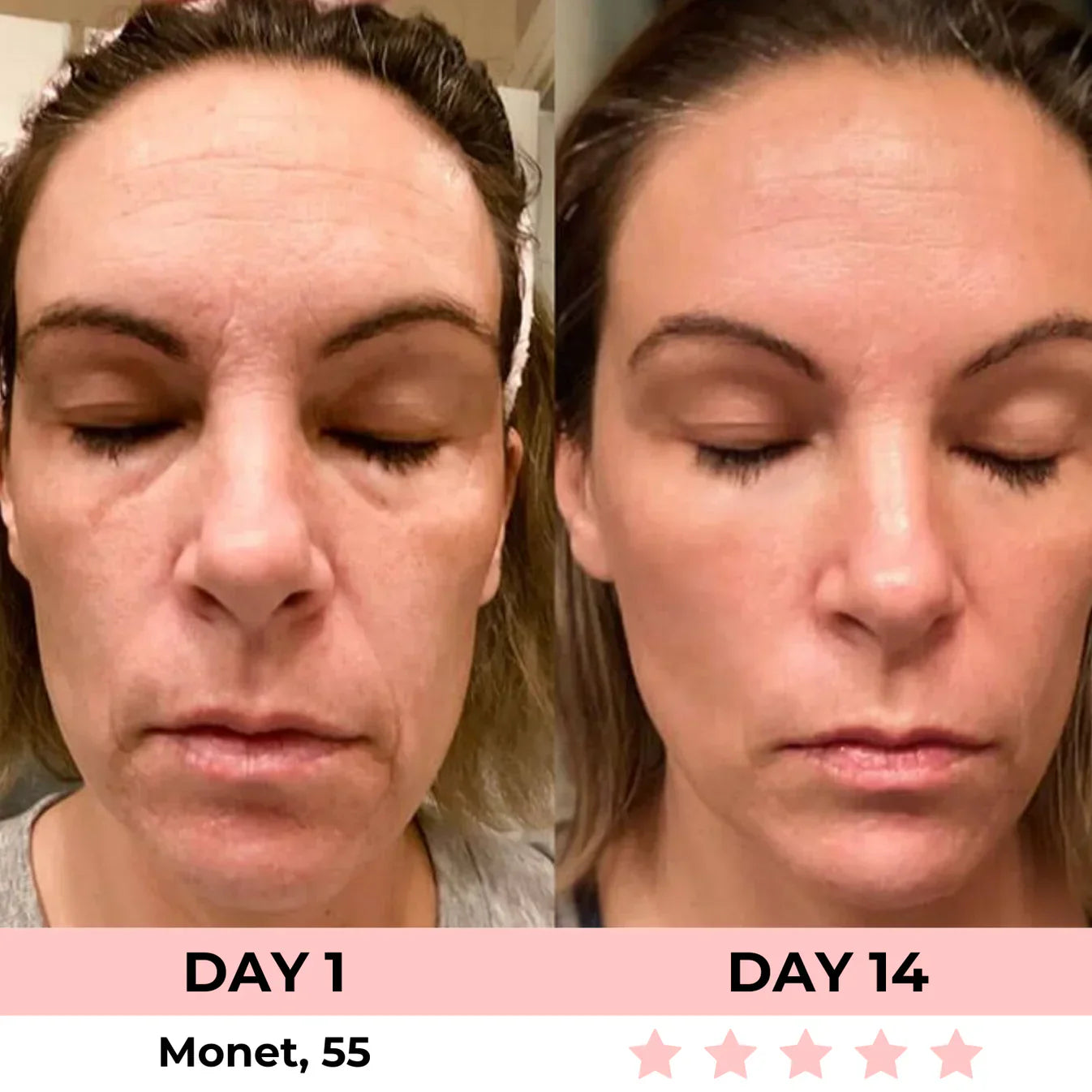 7-in-1 LED Facial Sculptor