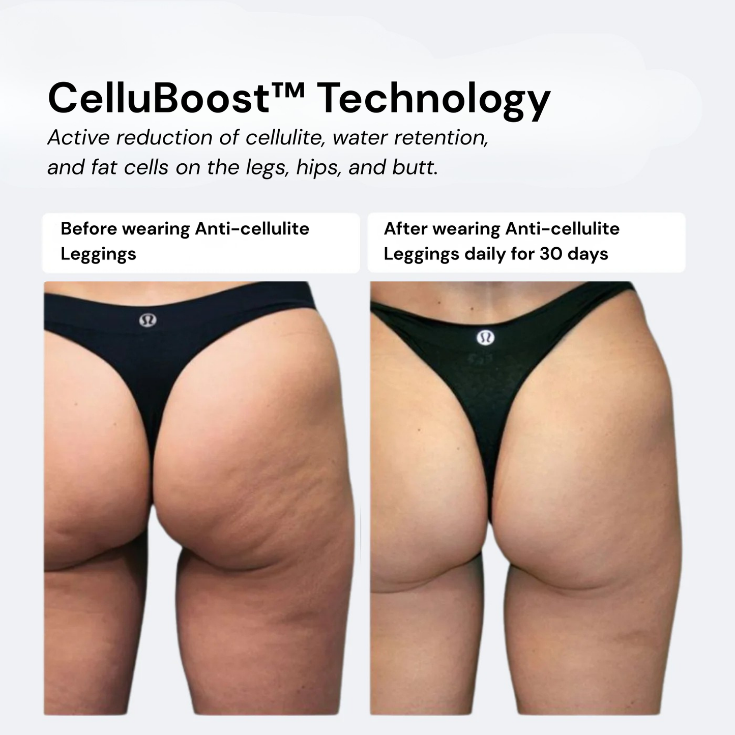 Anti-Cellulite Leggings