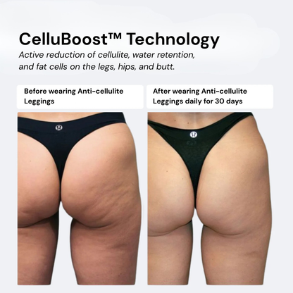 Anti-Cellulite Leggings
