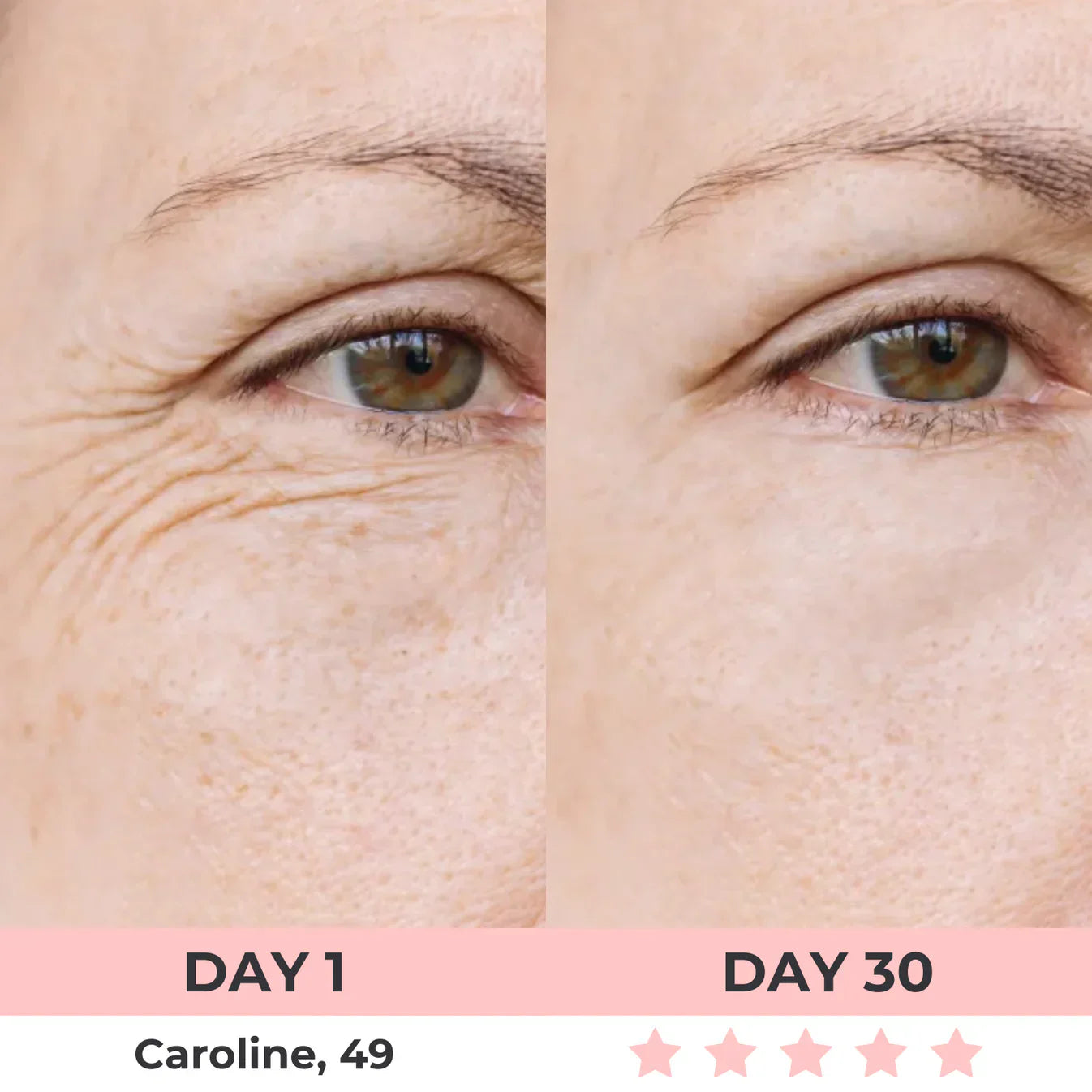 7-in-1 LED Facial Sculptor