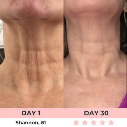 7-in-1 LED Facial Sculptor