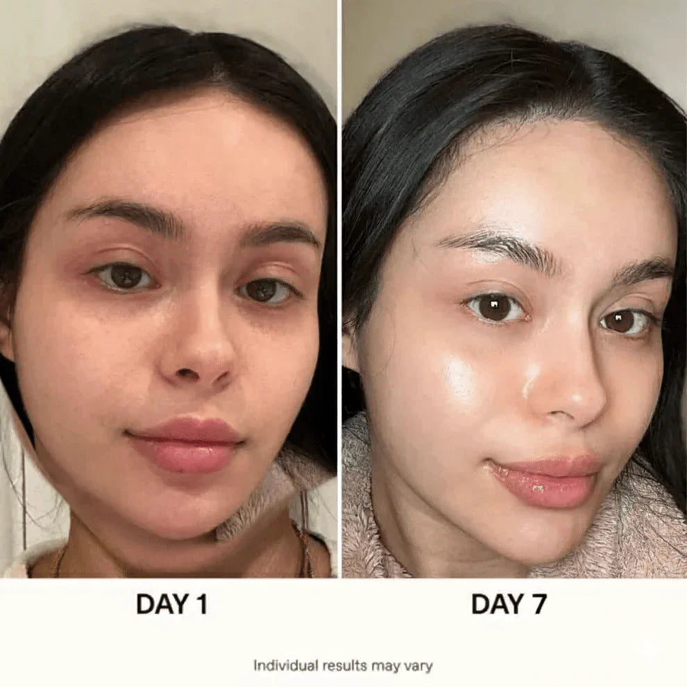 ANUA Ultimate Korean Skincare Set