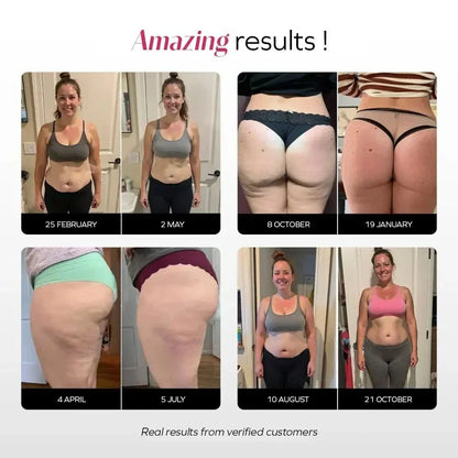 Anti-Cellulite Leggings